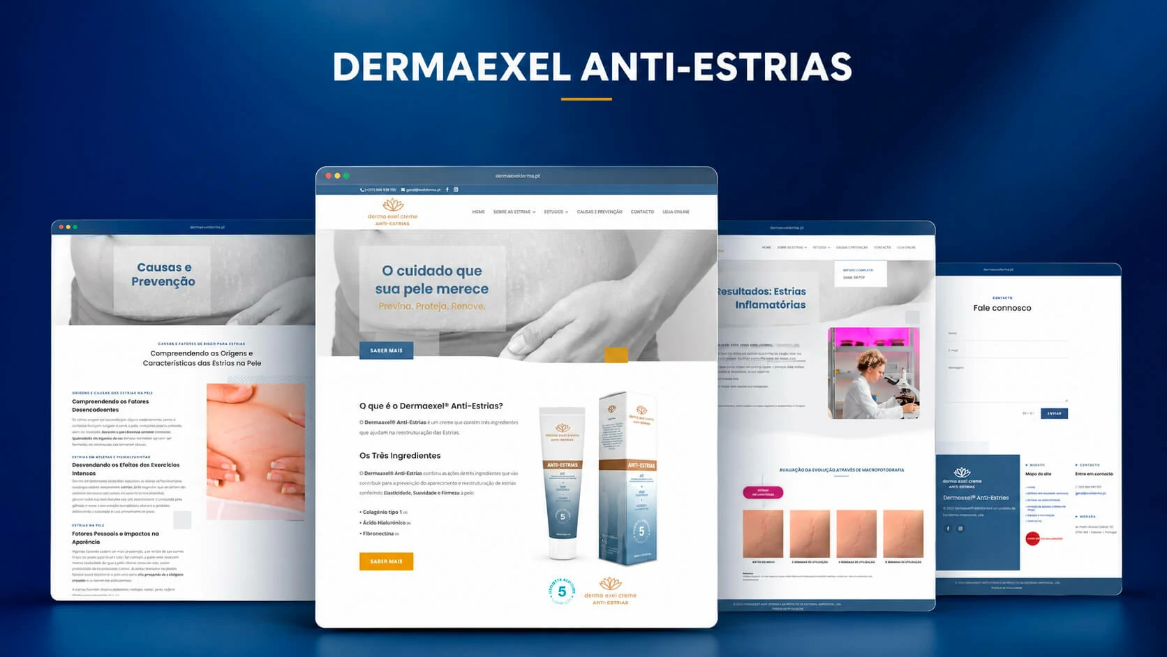 Completed Dermaexel Anti-Stretch Marks website showing homepage, causes and prevention, study results and contact page